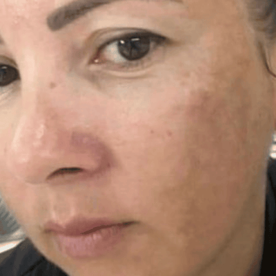 Antes - Laura Rodríguez